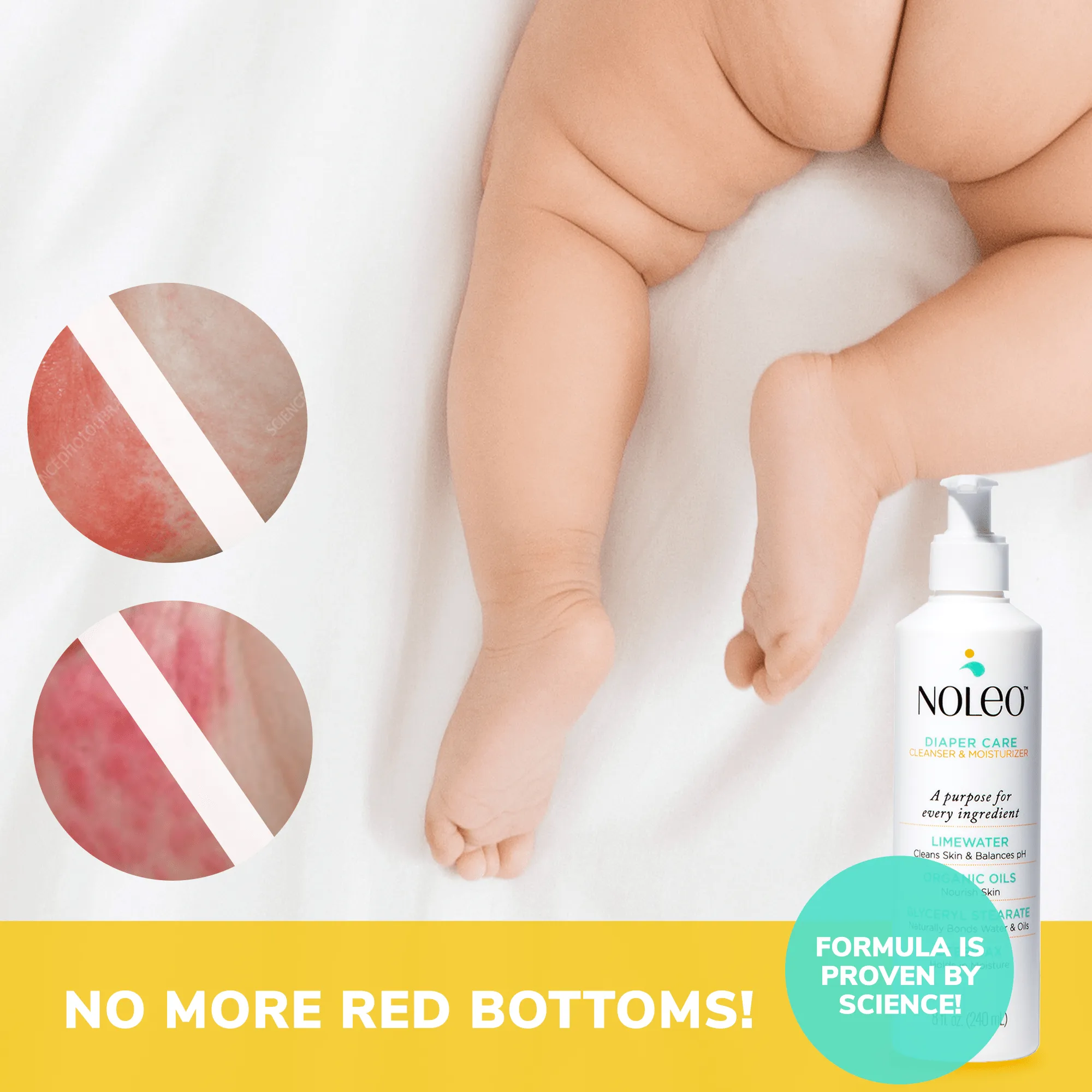 NOLEO 3-IN-1 (Pack of 3)